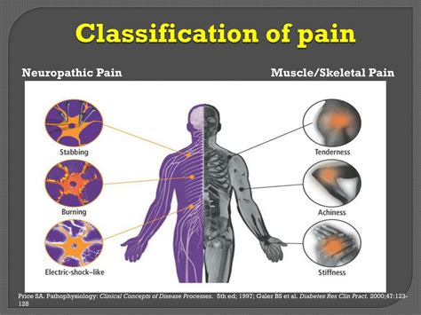 PPT - Neuropathic pain PowerPoint Presentation, free download - ID:7295757