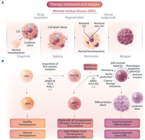 What Is Acute Myeloid Leukemia Aml Cancer Refractory Acute Myeloid