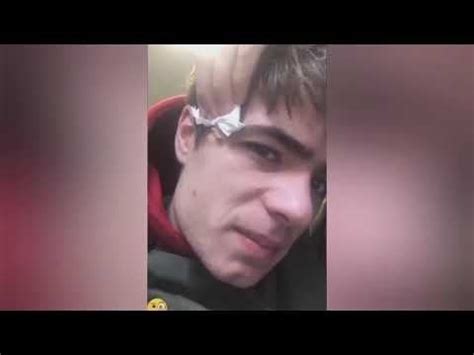 Image result for Large Pimples Exploding