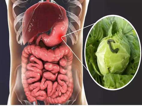 Protect yourself from hidden parasites in vegetables this winter