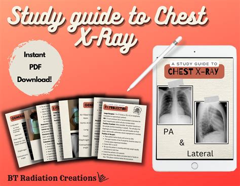 Image result for Chest X-Ray Tutorial