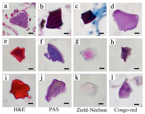 Diagnosis of Ion-Exchange Resin Depositions in Paraffin Sections Using ...