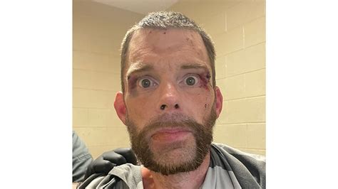 Morgan County inmate accused of biting corrections officer