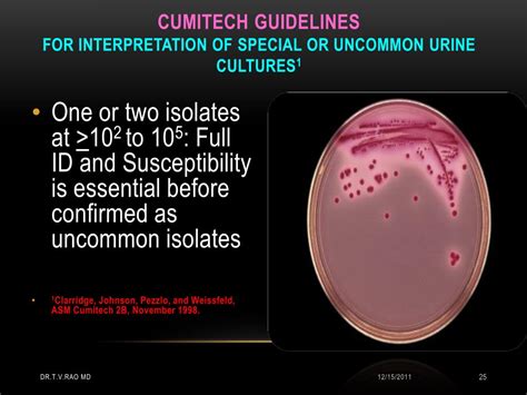 What Is Mixed Urogenital Flora In Urine at Winston Blanton blog