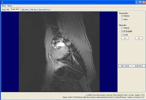 DICOM Query Retrieve Tool 的图像结果