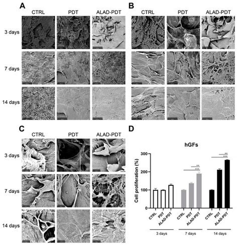 Photodynamic Therapy with Aminolevulinic Acid Enhances the Cellular ...