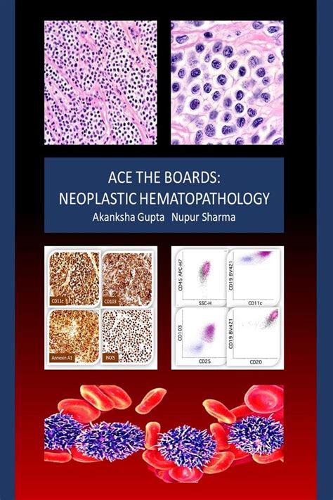 Buy Ace The Boards: Neoplastic Hematopathology Book Online at Low ...