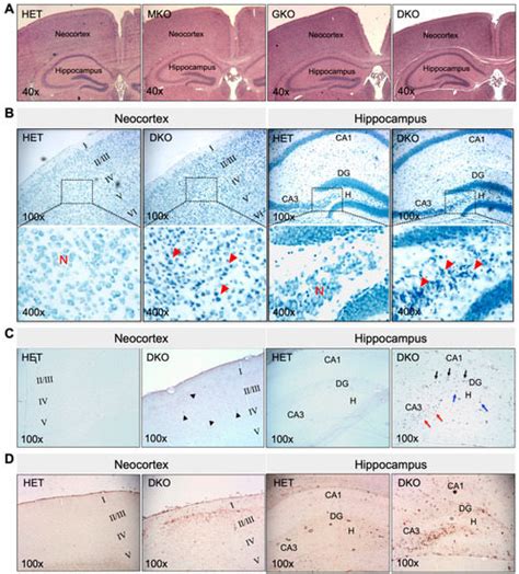 Fatal Epileptic Seizures in Mice Having Compromised Glutathione and ...