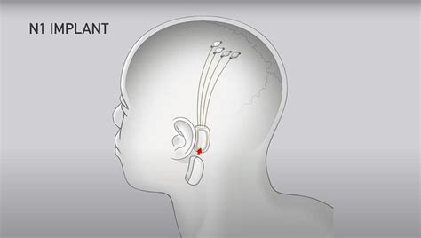 What Is Neuralink? How Does The Technology Work? | What Can A Person Do ...