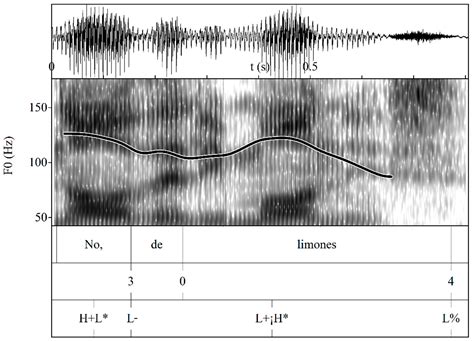 Basic Intonation Patterns of Galician Spanish