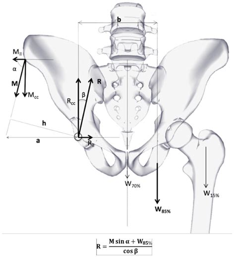 Analysis of the Risk of Wear on Cemented and Uncemented Polyethylene ...