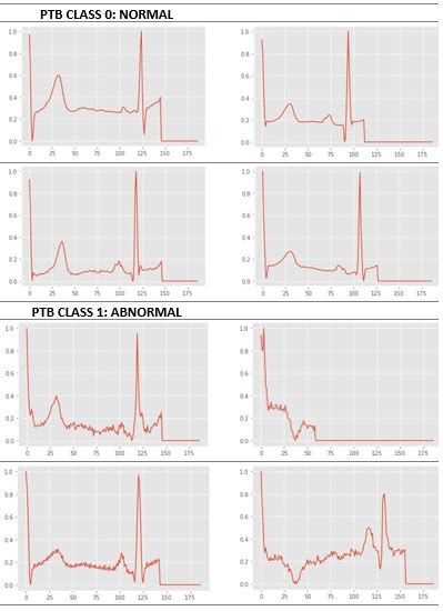 Labels of MIT-BIH Dataset 的图像结果