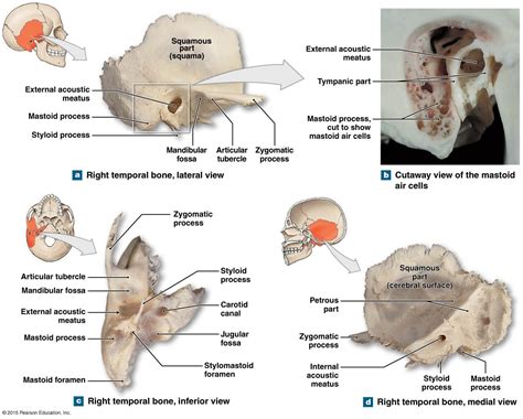 What Does The Temporal Bone Do at Ebony Sandoval blog