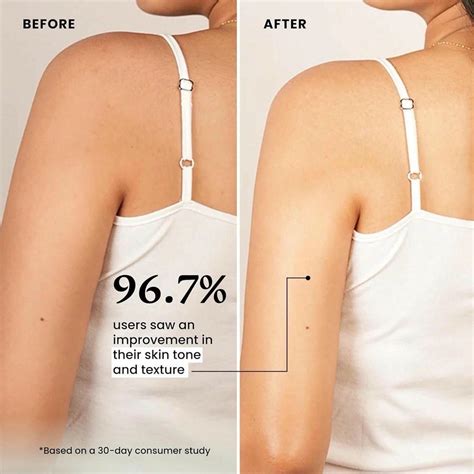 Kem Cot Brightening Cream – MaxSmile