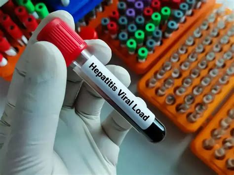 World Hepatitis Day 2023: World Hepatitis Day: Know about causes ...