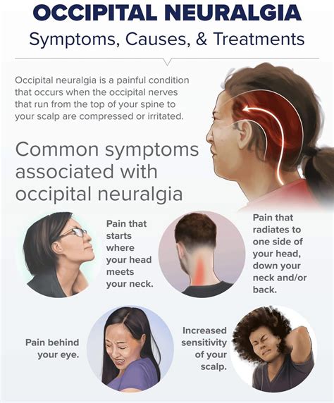 Injury - Neck and head pain - occipital neuralgia! The term 'Occipital ...