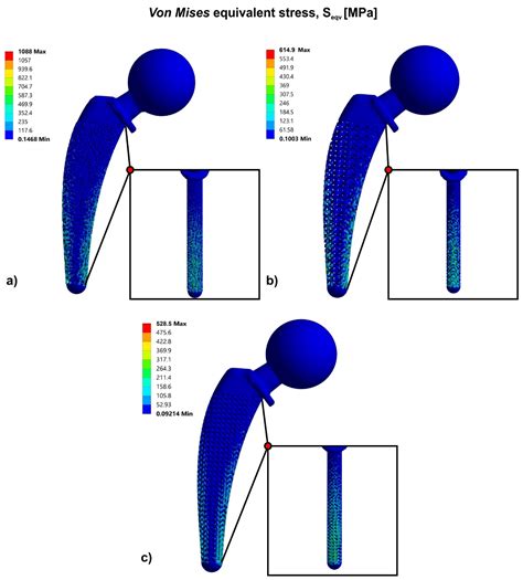 Finite Element Analysis of Orthopedic Hip Implant with Functionally ...