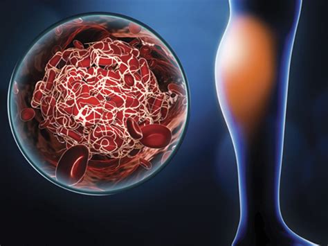 Resources You Need to Get Started with INR Testing | mdINR®