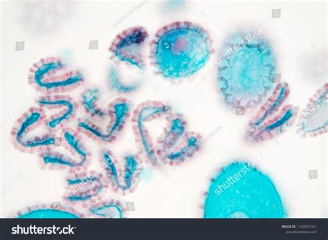 Image result for Flower Pollen Under Microscope