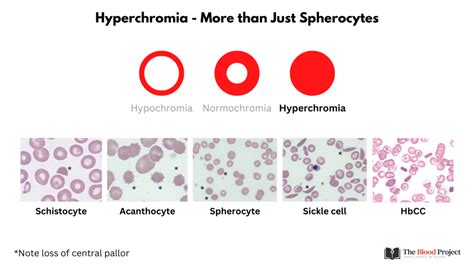 Image result for JavaScript Array Practice Questions
