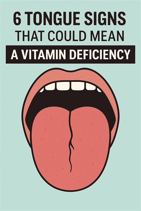 6 Tongue Signs of Vitamin Deficiency That Reveal Hidden Health Issues