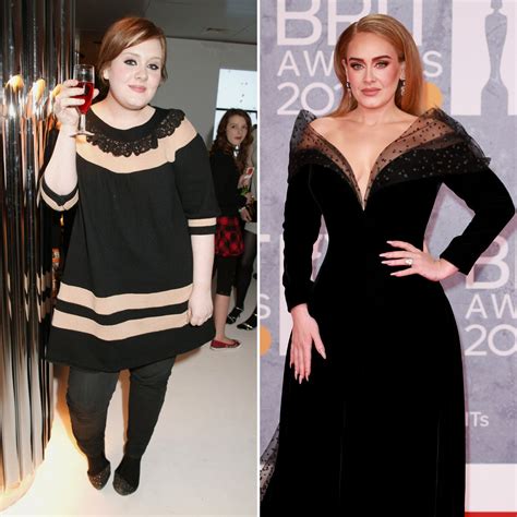 Did Adele Get Plastic Surgery? Transformation Photos | Life & Style