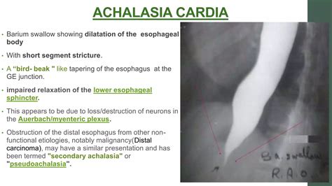 barium swallow EDIT.pptx