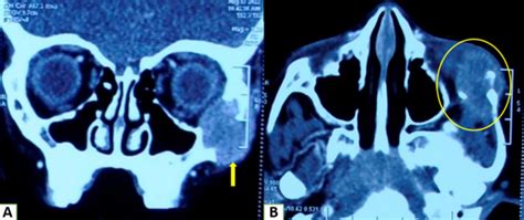 Oral Pathology: Case of the Month