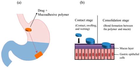 Current State and Future Perspectives on Gastroretentive Drug Delivery ...