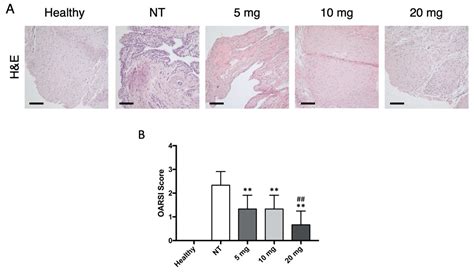 Bevacizumab Arrests Osteoarthritis Progression in a Rabbit Model: A ...