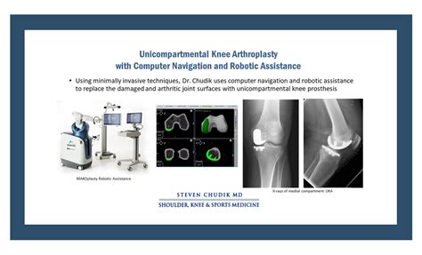 Unicompartmental Knee Arthroplasty (UKA) Robot Assisted (MAKOplasty ...