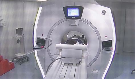 TDM Scanner 的图像结果