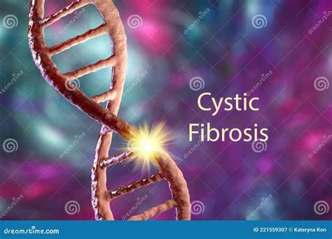Cystic Fibrosis Types Of Mutations at Megan Cisneros blog