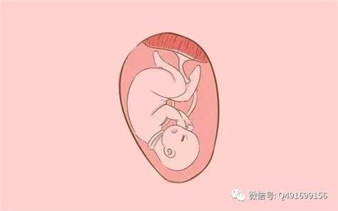 这些情况容易引起胎儿脐带绕颈窒息，孕妈们要注意了