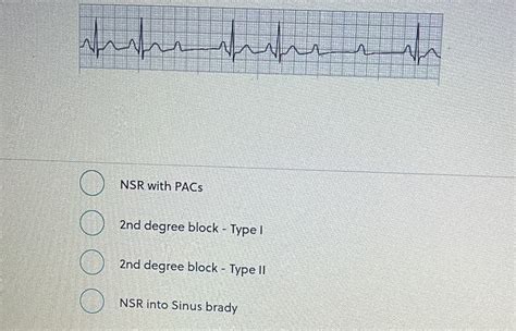 Solved NSR with PACs 2nd degree block - Type I 2nd degree | Chegg.com