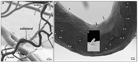 Collateral Vessels Have Unique Endothelial and Smooth Muscle Cell ...