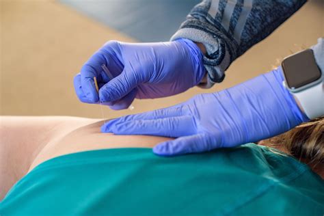 Pelvic Floor Symptoms: How Dry Needling Can Help — Anchor Physical ...