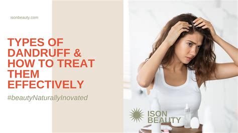 Types of Dandruff & How to Treat Them Effectively – ISON Beauty