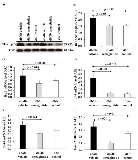Effects of the Topical Administration of Semaglutide on Retinal ...