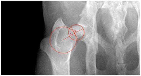 Morphometric Assessment of the Hip Joint in a Functional Dysplastic ...