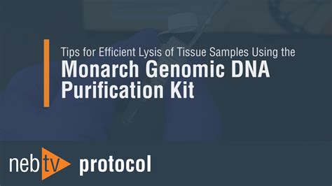 Genomic DNA Extraction & Purification | NEB