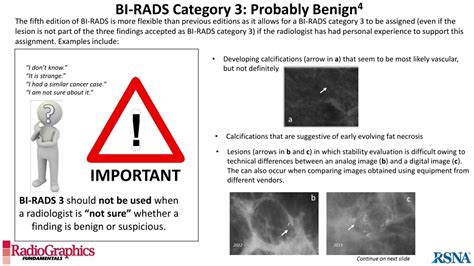 PPT - BI-RADS Terminology for Mammography Reports: What Residents Need to Know PowerPoint ...