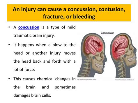 Head injury and its management | PPTX