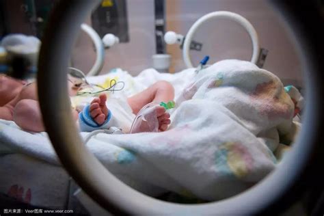 34周早产儿活下来的几率有多高 早产儿长大后有缺陷吗 _八宝网