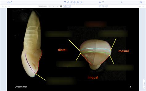 Line Angle Teeth 的图像结果