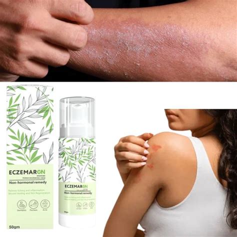 Fungal Infection Cream - Buy Fungal Infection Cream online at Best ...