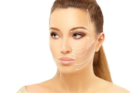 Image result for Thread Lift