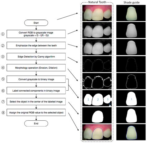 A Digital Shade-Matching Device for Dental Color Determination Using ...