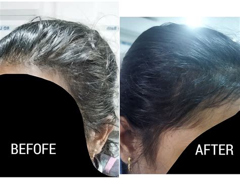 Kera XL Hair Growth Serum 60ml | Non-Sticky, Non-Viscous Hair Serum ...