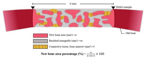 Bone Reconstruction Using Two-Layer Porcine-Derived Bone Scaffold ...